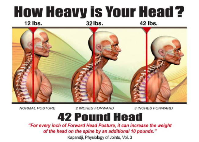 forward head posture